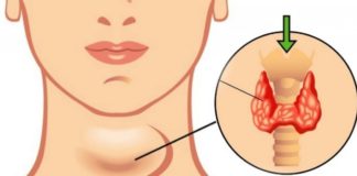 იოდი სასიცოცხლოდ მნიშვნელოვანია ჩვენი ჯანმრელობისთვის. როგორ მოვიქცეთ რომ იოდდეფიციტი ავიცილოთ?