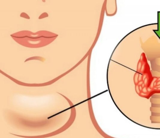 იოდი სასიცოცხლოდ მნიშვნელოვანია ჩვენი ჯანმრელობისთვის. როგორ მოვიქცეთ რომ იოდდეფიციტი ავიცილოთ?