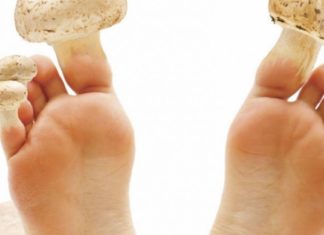 თუ ტერფის სოკო დაგესხათ თავს აი რა უნდა მოიმოქმედოთ სასწრაფოდ