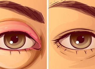 თუ ხშირად გიშუპდებათ თვალები და ქუთუთოები, გასწავლით ყველაზე ეფექტურ მეთოდებს