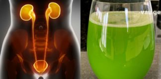 თუ ორგანიზმში სითხე გრჩებათ, მიიღეთ შარდმდენები და თირკმლები მცენარეული ნაყენებით გაიწმინდეთ