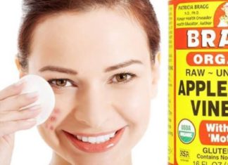 6 საოცარი მეთოდი ვაშლის ძმრით კანის მდგომარეობის გასაუმჯობესებლად