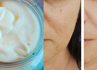 სახლში დამზადებული ნაოჭების სააწინააღმდეგო კრემი : მიიღეთ შედეგი სულ რაღაც 7 დღეში