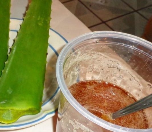 ყოველთვის ამ ხერხს მივმართავ როცა რადიკულიტი შემომიტევს