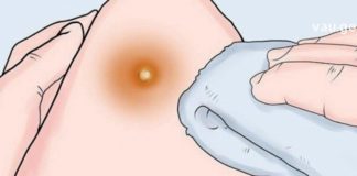 ეს სასწაულმოქმედი საშუალება ერთი დადებით არჩენს ძირმაგარას