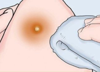 ეს სასწაულმოქმედი საშუალება ერთი დადებით არჩენს ძირმაგარას