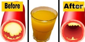 ეს სასმელი გაწმენდს არტერიებს და დაიცავს თქვენს გულს!