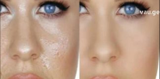 დღეს თქვენთვის იღბლიანი დღეა, რადგან ამ სტატიაში გაგიზიარებთ, როგორ გააკეთოთ საუკეთესო ნიღბები თუ ცხიმიანი კანი გაქვთ