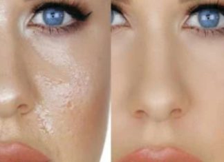 დღეს თქვენთვის იღბლიანი დღეა, რადგან ამ სტატიაში გაგიზიარებთ, როგორ გააკეთოთ საუკეთესო ნიღბები თუ ცხიმიანი კანი გაქვთ