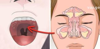 როგორ მოვიქცეთ გახანგრძლივებული სურდოს და ხველის დროს