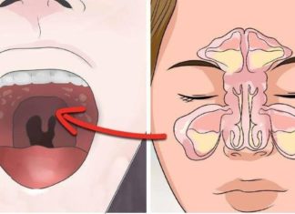 როგორ მოვიქცეთ გახანგრძლივებული სურდოს და ხველის დროს