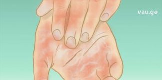 სისხლის Ცუდი ცირკულაცია, ცივი ფეხები და ხელები – აი, როგორ უნდა გადაიჭრას ეს პრობლემა!