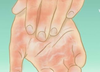 სისხლის Ცუდი ცირკულაცია, ცივი ფეხები და ხელები – აი, როგორ უნდა გადაიჭრას ეს პრობლემა!