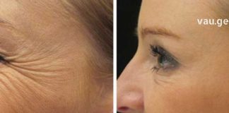 Დაემშვიდობეთ ნაოჭებს! უბრალოდ გამოიყენეთ ეს სანელებელი და გაახანგრძლივეთ ახალგაზრდობის დრო!