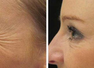 Დაემშვიდობეთ ნაოჭებს! უბრალოდ გამოიყენეთ ეს სანელებელი და გაახანგრძლივეთ ახალგაზრდობის დრო!