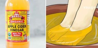 აი რა მოხდება, თუ ფეხებს ძმარში ჩადებთ. ამას ვაკეთებ ყოველ საღამოს!