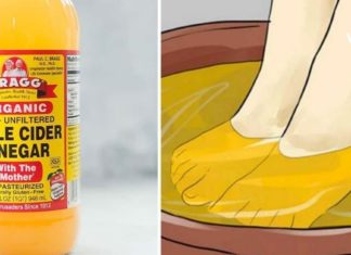 აი რა მოხდება, თუ ფეხებს ძმარში ჩადებთ. ამას ვაკეთებ ყოველ საღამოს!