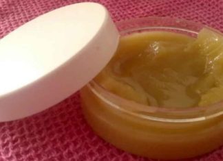 ბებოს გასაოცარმა მალამომ დამწვრობის კვალი გამიქრო