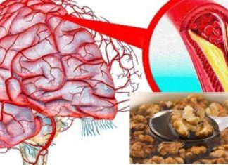 თავის ტვინის სისხლძარღვების გაწმენდა: მარტივი რეცეპტები და რჩევები