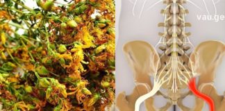 როგორ მოვიქცეთ საჯდომი ნერვის ანთების დროს? ხალხურ მედიცინას საუკეთესო შემოთავაზება აქვს