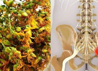 როგორ მოვიქცეთ საჯდომი ნერვის ანთების დროს? ხალხურ მედიცინას საუკეთესო შემოთავაზება აქვს