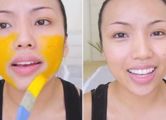 კურკუმით დამზადებული სახის ნიღაბი საოცრებებს ახდენს კანზე