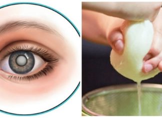 კატარაქტას მკურნალობა არც თუ ისე რთულია როგორც თქვენ წარმოგიდგენიათ – მცენარეული რეცეპტებით უმოკლეს დროში გადაჭრით ამ პრობლემას.