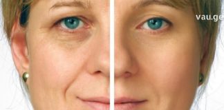 ჩემმა დედამთილმა გამიმხილა სასწაულმოქმედი ნიღბის რეცეპტი, რომლის წყალობითაც ერთი ნაოჭიც კი არ აქვს