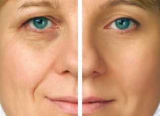 ჩემმა დედამთილმა გამიმხილა სასწაულმოქმედი ნიღბის რეცეპტი, რომლის წყალობითაც ერთი ნაოჭიც კი არ აქვს