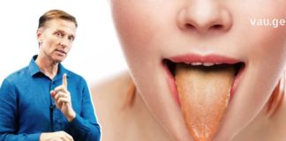 შეხედეთ თქვენი ენის ფერს და გაიგებთ რომელი დაავადება გაწუხებთ