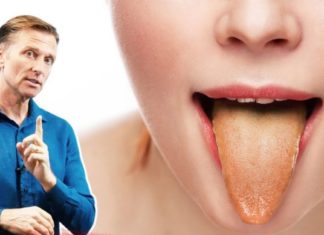 შეხედეთ თქვენი ენის ფერს და გაიგებთ რომელი დაავადება გაწუხებთ