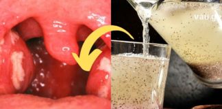 სცადეთ ეს Მარტივი და სწრაფი რეცეპტი – ანგინას 4 საათში მოირჩენთ და პრაქტიკულად ჯანმრთელი იქნებით!