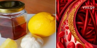 ბერძნული Ხალხური მედიცინა – უძველესი რეცეპტი არტერიების გასაწმენდად