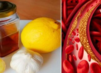 ბერძნული Ხალხური მედიცინა – უძველესი რეცეპტი არტერიების გასაწმენდად