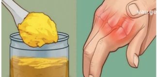 ართროზით გამოწვეულ ტკივილს ეს საშუალებები დაგიამებთ – მათი ეფექტურობა დადასტურებულია