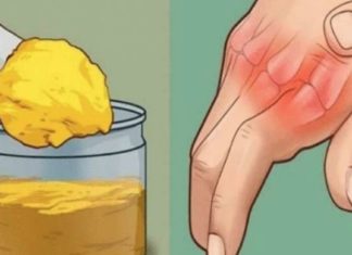 ართროზით გამოწვეულ ტკივილს ეს საშუალებები დაგიამებთ – მათი ეფექტურობა დადასტურებულია