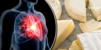 Როგორ მოქმედებს ყველი ქოლესტერინის დონეზე?