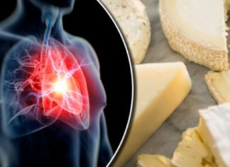 Როგორ მოქმედებს ყველი ქოლესტერინის დონეზე?