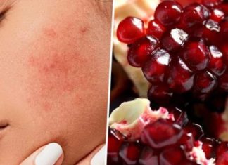 ბროწეულის 3 წარმოუდგენელი სარგებელი თქვენი კანისთვის, რომელიც უნდა იცოდეთ