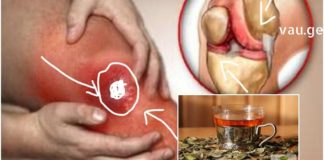 რევმატიზმის განკურნება მხოლოდ ამ საშუალებებით არის შესაძლებელი – საკუთარ თავზე გამოვცადე!