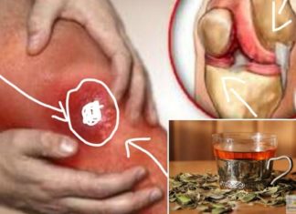 რევმატიზმის განკურნება მხოლოდ ამ საშუალებებით არის შესაძლებელი – საკუთარ თავზე გამოვცადე!