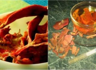 ხერხი, რომელიც ბევრმა სცადა ჭიების მოსაცილებლად და გაამართლა : აუცილებლად გიშველით !