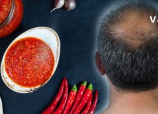 წიწაკამ და ნიორმა თმის ცვენა შემიჩერა – მარტივად მოსამზადებელი წამალი !