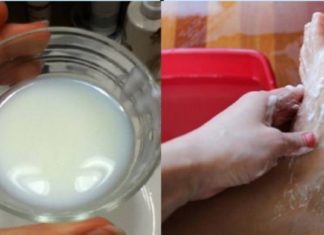 კოჟიჟის მკურნალობის ჩემეული მეთოდი მაქვს, რომელიც, მინდა თქვენც გაგიზიაროთ – პირველივე ცდაზე გაამართლა !