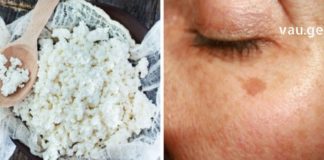 ეს ბევრმა ჯერ კიდევ არ იცის – ხაჭო კოსმეტოლოგიაში ნამდვილი აღმოჩენაა