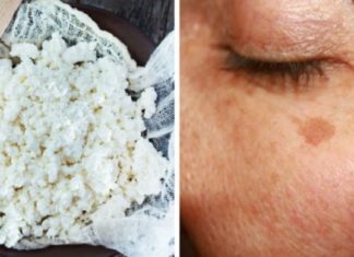 ეს ბევრმა ჯერ კიდევ არ იცის – ხაჭო კოსმეტოლოგიაში ნამდვილი აღმოჩენაა