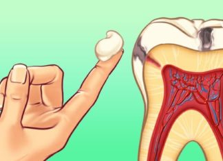 ეფექტური საშუალებები კბილის ტკივილისას – დროში გამოცდილი რეცეპტები