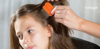 ტილების საწინააღმდეგო ნაცადი მეთოდი