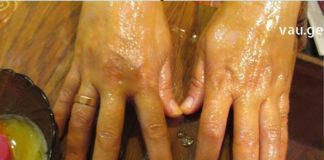 დერმატოლოგებიც კი შოკში ჩავარდნენ როცა ჩემი მეთოდები გავუზიარე კანის მოსავლელად !