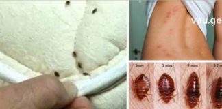 თქვენი საწოლი სავსეა ტკიპებით: ყველაფერი მათ შესახებ ! – რისი ეშინიათ და როგორ მოვიშოროთ ?!